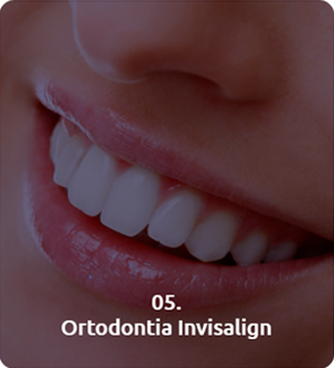 vd154888621452